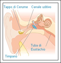 Tappi di cerume ed otite cronica